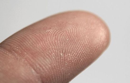 Fingerprint